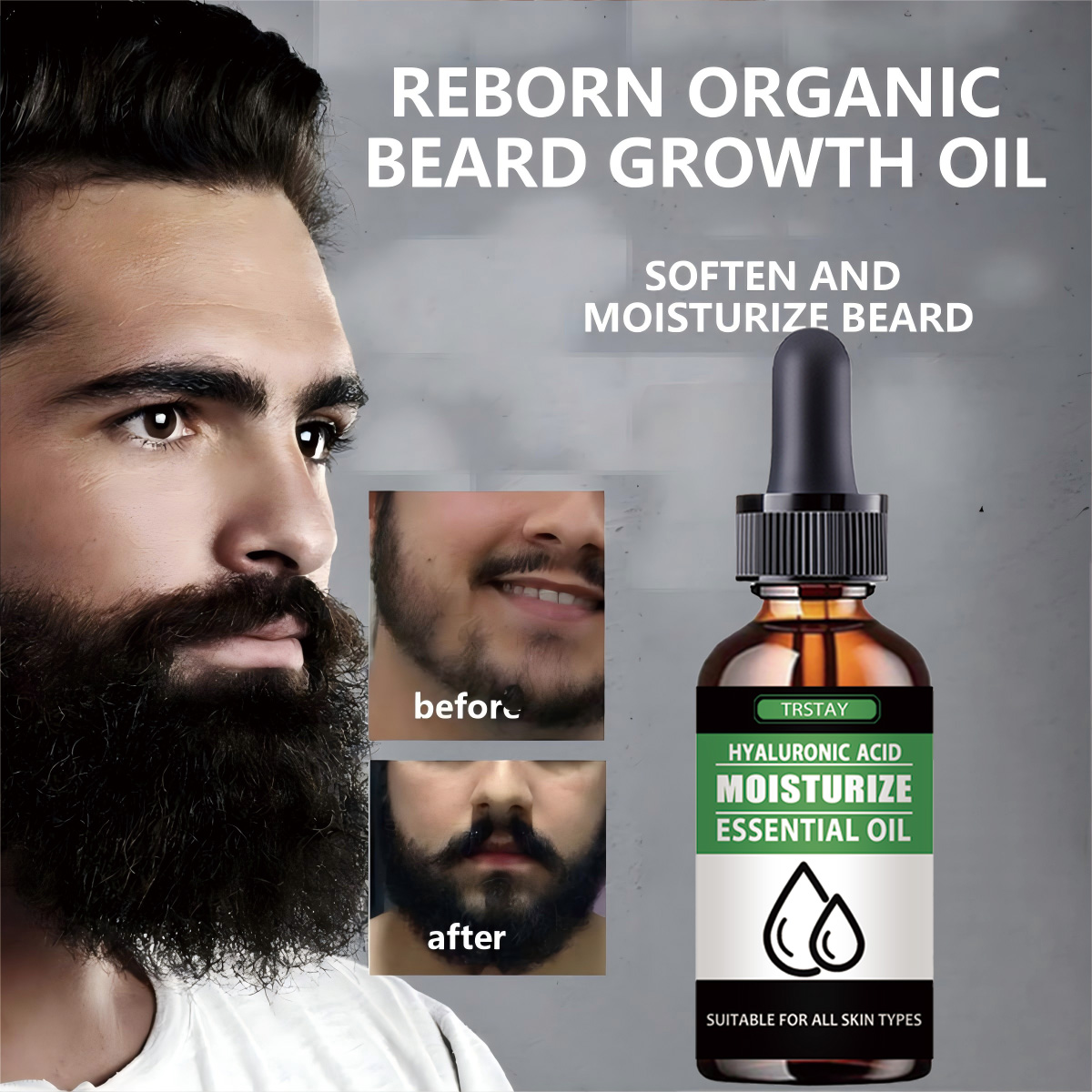Hair Care Natural Products - 100% Natural acelera el vello Facial