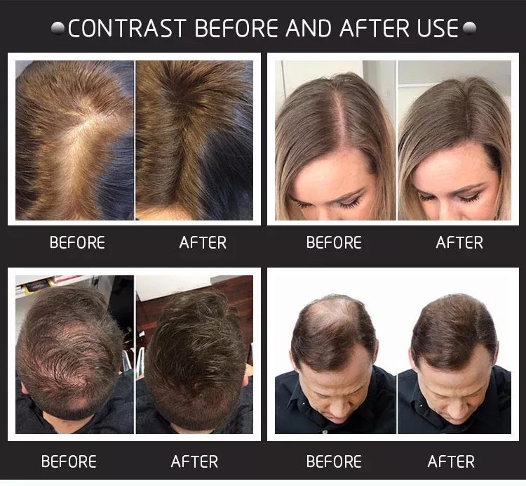 Fibras Capilares de 28g con Pu - Hair Care Natural Products reseña y precio
