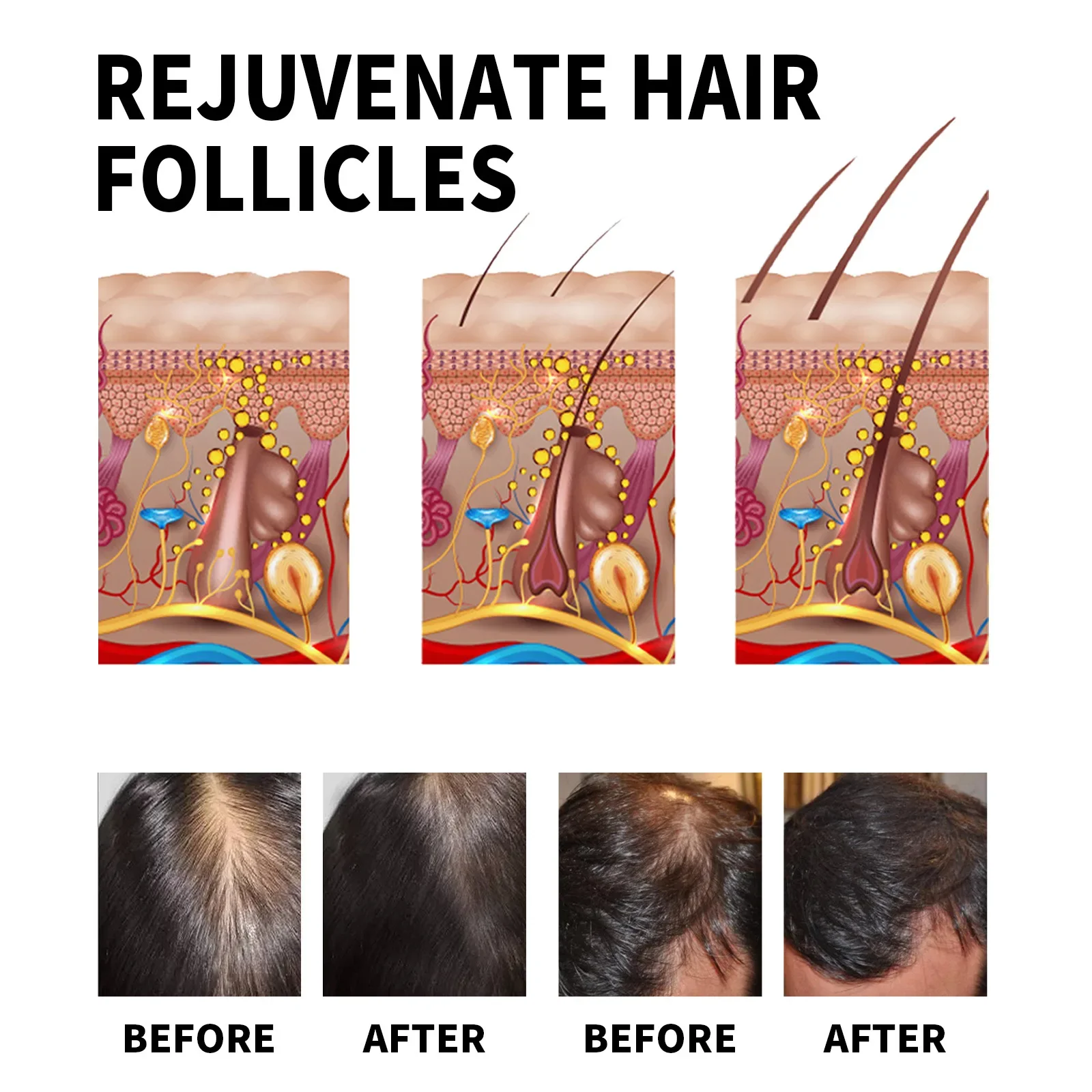 Productos para el crecimiento  - Hair Care Natural Products reseña y precio