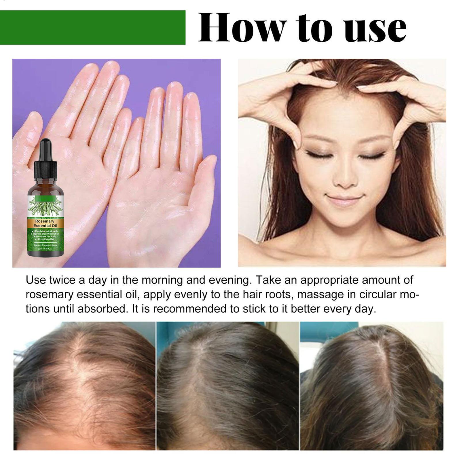 Aceite Esencial de Romero para - Hair Care Natural Products reseña y precio
