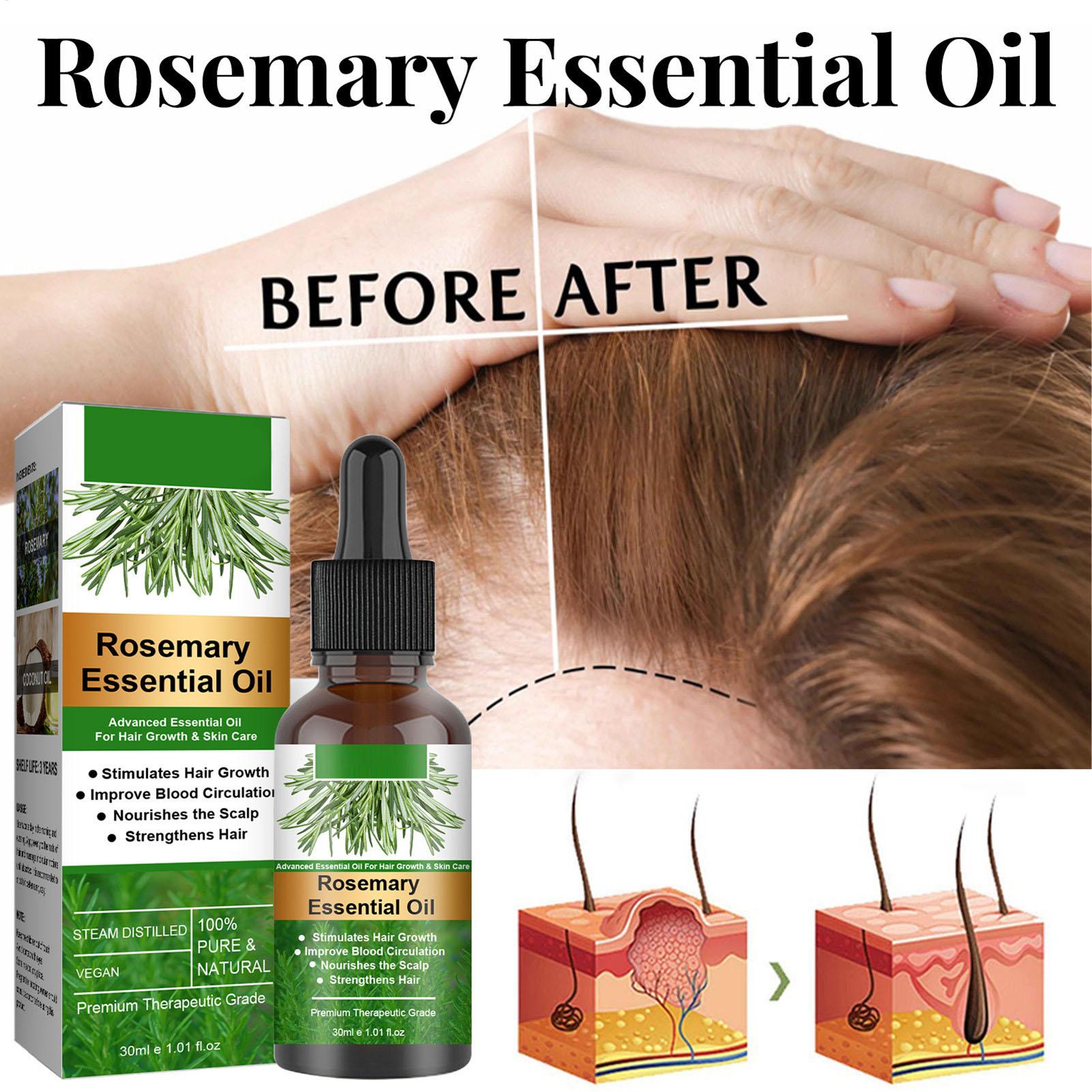 Aceite Esencial de Romero para - Hair Care Natural Products reseña y precio